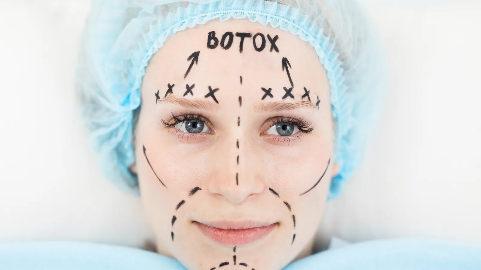 Botulinumtoxin (Botox) in der HNO und ästhetischen Medizin